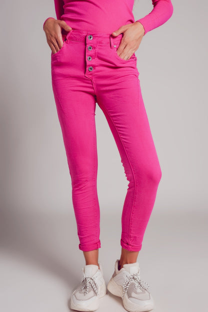 Q2 Exposed buttons skinny jeans in fuchsia